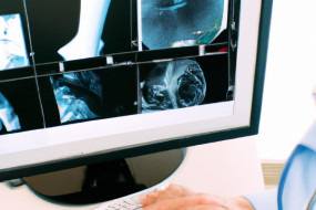 Advancements and Limitations of AI in Medical Imaging and Diagnostics